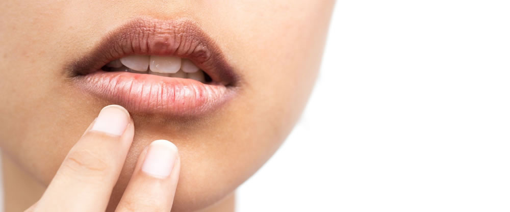 お口が乾燥するドライマウスの原因・改善方法とは？