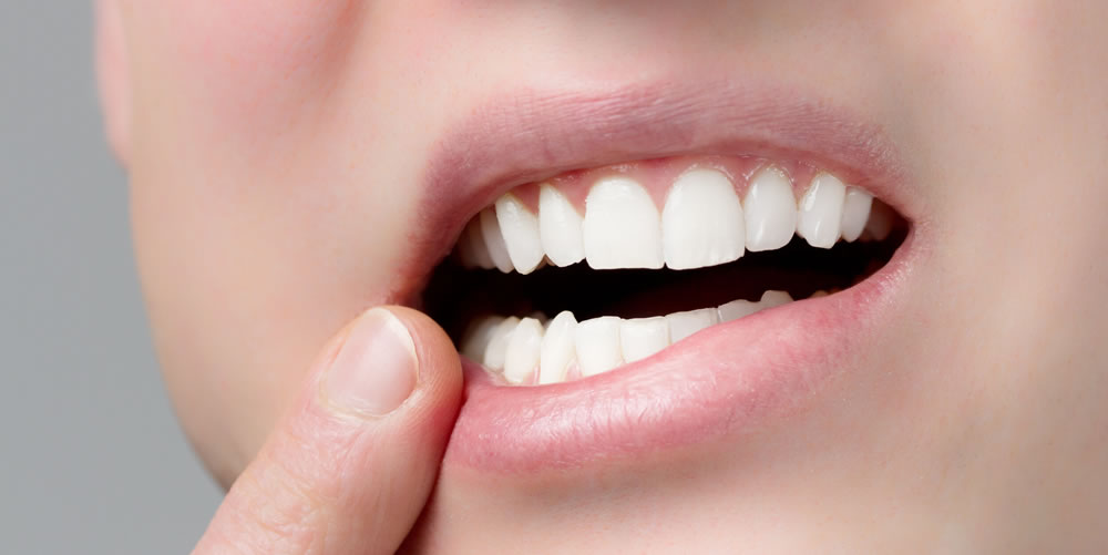 歯が抜けた状態で放置した場合に起こりうる問題とは？