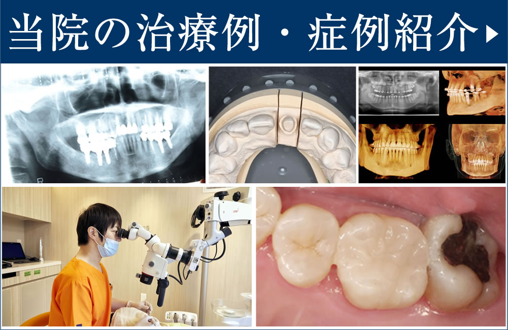 症例・治療例