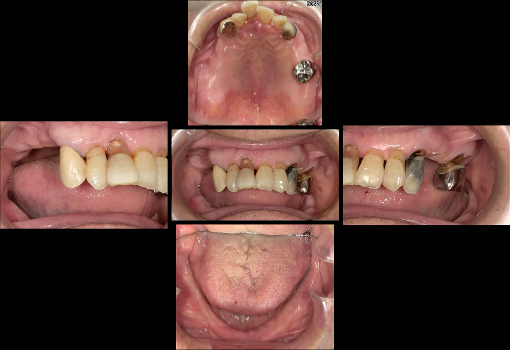 初診時のお口の状態