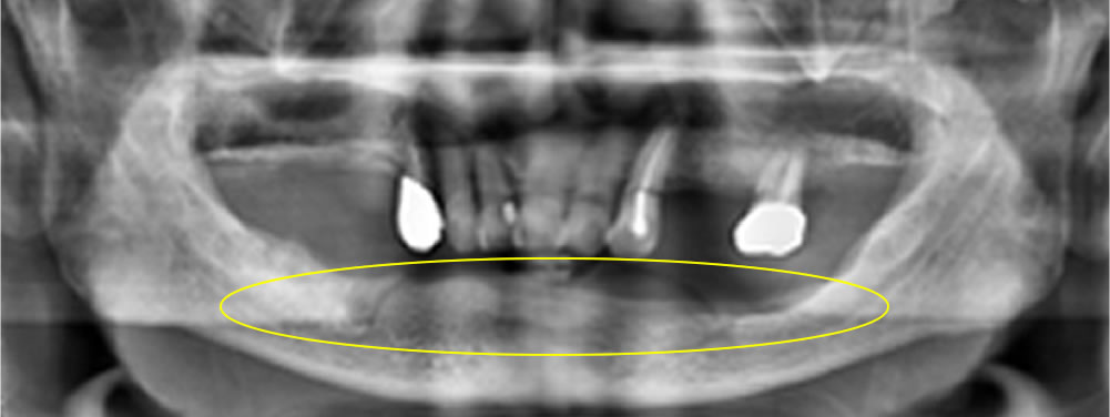 初診時のお口の状態