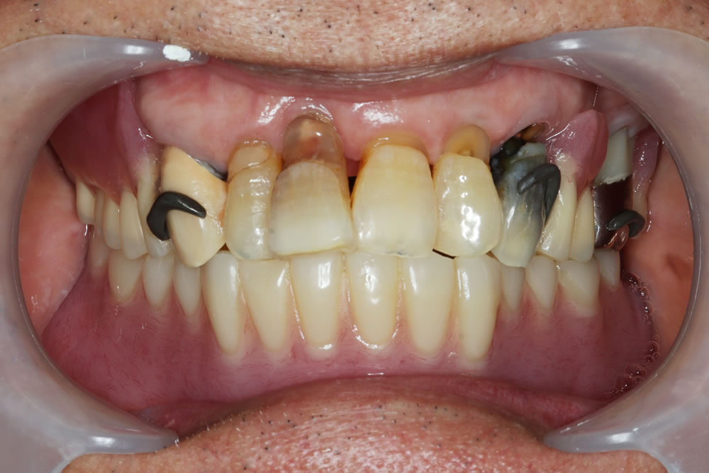 初診時のお口の状態