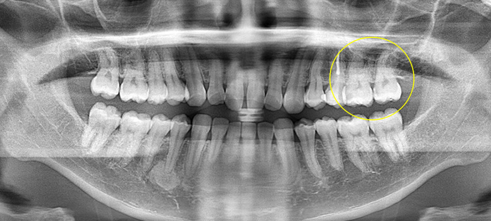 来院時のお口の状態
