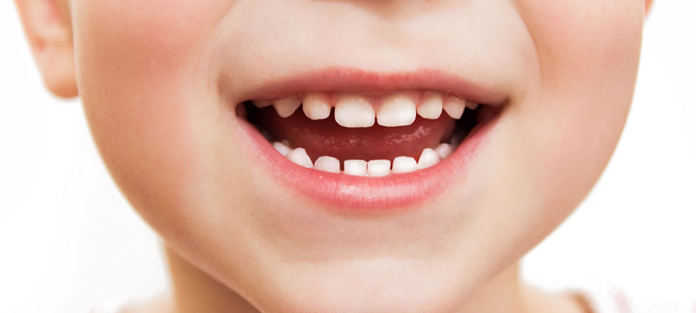 子どもの歯（乳歯）の抜歯